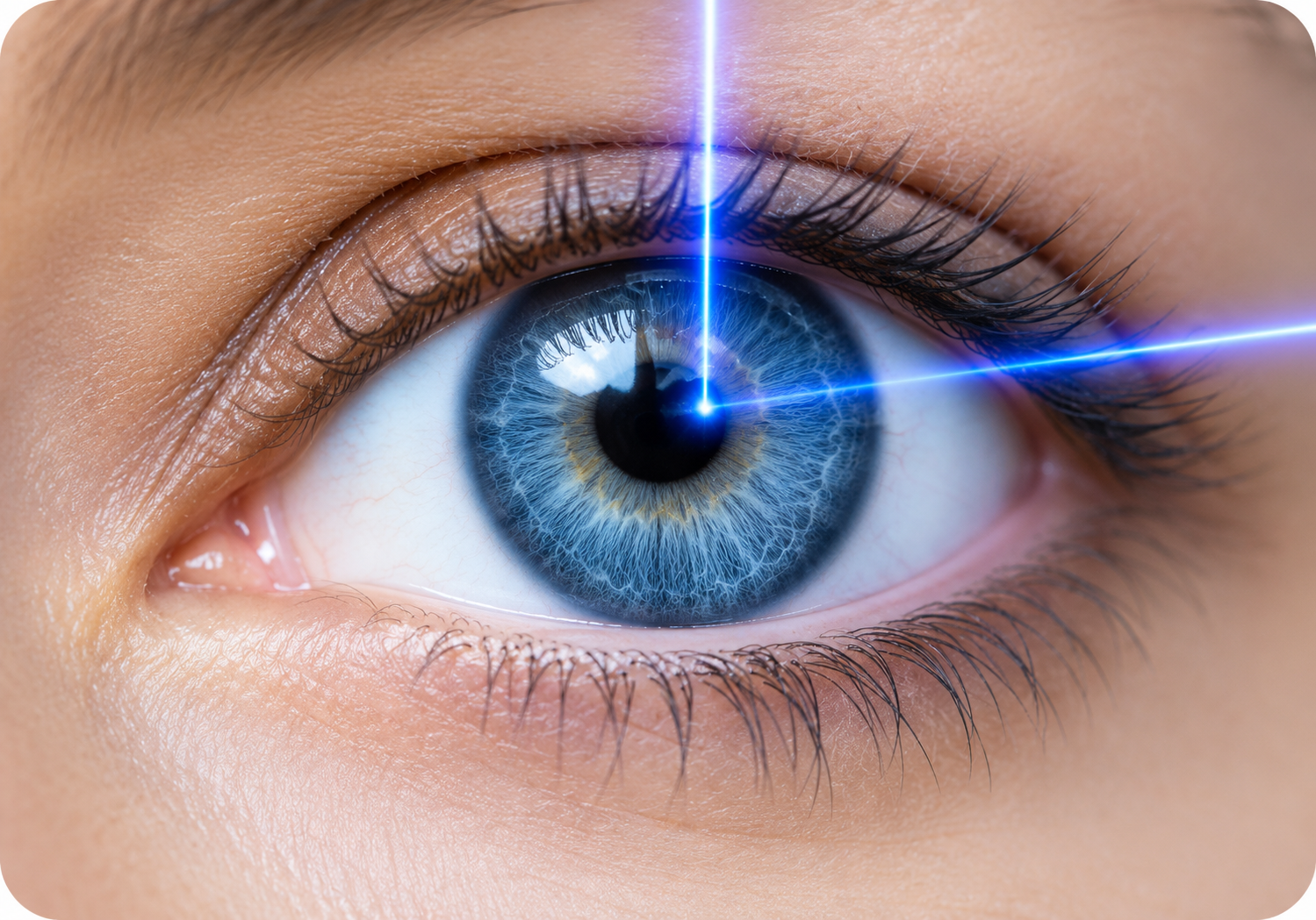 SMILE Eye Surgery in Shivaji Nagar